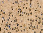 RBM26 Antibody in Immunohistochemistry (Paraffin) (IHC (P))