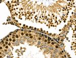 RBM26 Antibody in Immunohistochemistry (Paraffin) (IHC (P))