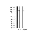 RBM26 Antibody in Western Blot (WB)