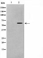 RAD18 Antibody in Western Blot (WB)