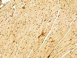 Phospho-FOXO3A (Ser253) Antibody in Immunohistochemistry (Paraffin) (IHC (P))