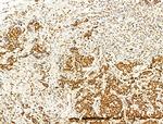 Phospho-FOXO3A (Ser253) Antibody in Immunohistochemistry (Paraffin) (IHC (P))