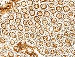 Phospho-FOXO3A (Ser253) Antibody in Immunohistochemistry (Paraffin) (IHC (P))