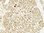 Phospho-FOXO3A (Ser253) Antibody in Immunohistochemistry (Paraffin) (IHC (P))