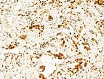 Phospho-FOXO3A (Ser253) Antibody in Immunohistochemistry (Paraffin) (IHC (P))