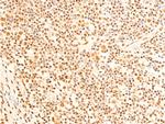 Phospho-FOXO3A (Ser253) Antibody in Immunohistochemistry (Paraffin) (IHC (P))