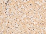 Phospho-FOXO3A (Ser253) Antibody in Immunohistochemistry (Paraffin) (IHC (P))