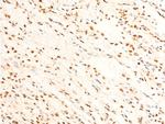 Phospho-FOXO3A (Ser253) Antibody in Immunohistochemistry (Paraffin) (IHC (P))