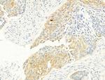 Phospho-ROCK2 (Tyr722) Antibody in Immunohistochemistry (Paraffin) (IHC (P))