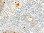 Phospho-ROCK2 (Tyr722) Antibody in Immunohistochemistry (Paraffin) (IHC (P))