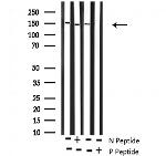 Phospho-ROCK2 (Tyr722) Antibody in Western Blot (WB)