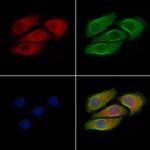 Phospho-B-Raf (Thr599) Antibody in Immunocytochemistry (ICC/IF)