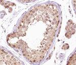 Phospho-B-Raf (Thr599) Antibody in Immunohistochemistry (Paraffin) (IHC (P))