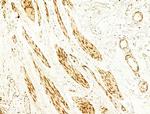 Phospho-JNK1/JNK2/JNK3 (Thr183, Tyr185) Antibody in Immunohistochemistry (Paraffin) (IHC (P))