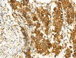 Phospho-JNK1/JNK2/JNK3 (Thr183, Tyr185) Antibody in Immunohistochemistry (Paraffin) (IHC (P))