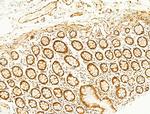 Phospho-JNK1/JNK2/JNK3 (Thr183, Tyr185) Antibody in Immunohistochemistry (Paraffin) (IHC (P))