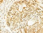 Phospho-JNK1/JNK2/JNK3 (Thr183, Tyr185) Antibody in Immunohistochemistry (Paraffin) (IHC (P))