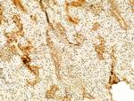 Phospho-JNK1/JNK2/JNK3 (Thr183, Tyr185) Antibody in Immunohistochemistry (Paraffin) (IHC (P))