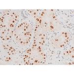 Phospho-JNK1/JNK2/JNK3 (Thr183, Tyr185) Antibody in Immunohistochemistry (Paraffin) (IHC (P))