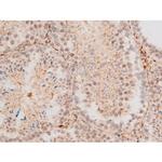 Phospho-JNK1/JNK2/JNK3 (Thr183, Tyr185) Antibody in Immunohistochemistry (Paraffin) (IHC (P))