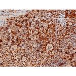 Phospho-JNK1/JNK2/JNK3 (Thr183, Tyr185) Antibody in Immunohistochemistry (Paraffin) (IHC (P))