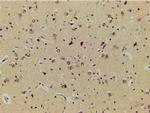 Phospho-LIMK1 (Thr508) Antibody in Immunohistochemistry (Paraffin) (IHC (P))