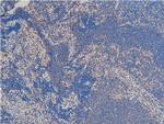 Phospho-LIMK1 (Thr508) Antibody in Immunohistochemistry (Paraffin) (IHC (P))