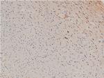 Phospho-LIMK1 (Thr508) Antibody in Immunohistochemistry (Paraffin) (IHC (P))