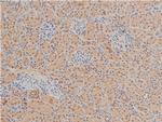 Phospho-LIMK1 (Thr508) Antibody in Immunohistochemistry (Paraffin) (IHC (P))