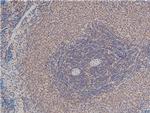 Phospho-LIMK1 (Thr508) Antibody in Immunohistochemistry (Paraffin) (IHC (P))