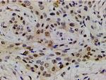 Phospho-LIMK1 (Thr508) Antibody in Immunohistochemistry (Paraffin) (IHC (P))