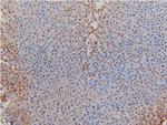 Phospho-LIMK1 (Thr508) Antibody in Immunohistochemistry (Paraffin) (IHC (P))