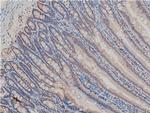 Phospho-LIMK1 (Thr508) Antibody in Immunohistochemistry (Paraffin) (IHC (P))