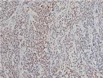 Phospho-LIMK1 (Thr508) Antibody in Immunohistochemistry (Paraffin) (IHC (P))