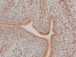 Phospho-LIMK1 (Thr508) Antibody in Immunohistochemistry (Paraffin) (IHC (P))