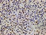 Phospho-LIMK1 (Thr508) Antibody in Immunohistochemistry (Paraffin) (IHC (P))