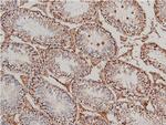 Phospho-LIMK1 (Thr508) Antibody in Immunohistochemistry (Paraffin) (IHC (P))