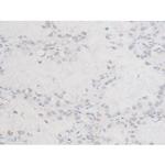 Phospho-LIMK1 (Thr508) Antibody in Immunohistochemistry (Paraffin) (IHC (P))