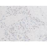 Phospho-LIMK1 (Thr508) Antibody in Immunohistochemistry (Paraffin) (IHC (P))