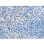 Phospho-LIMK1 (Thr508) Antibody in Immunohistochemistry (Paraffin) (IHC (P))