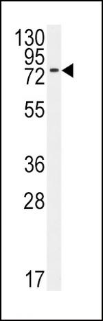 BMPR1A Antibody in Western Blot (WB)