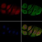 Phospho-Ataxin 1 (Ser775) Antibody in Immunocytochemistry (ICC/IF)