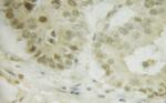 Phospho-IRF3 (Ser386) Antibody in Immunohistochemistry (Paraffin) (IHC (P))