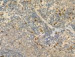 Phospho-IRF3 (Ser386) Antibody in Immunohistochemistry (Paraffin) (IHC (P))