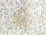 Phospho-IRF3 (Ser386) Antibody in Immunohistochemistry (Paraffin) (IHC (P))