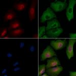 Phospho-FGFR1/FGFR2 (Tyr463, Tyr466) Antibody in Immunocytochemistry (ICC/IF)