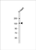 BMPR2 Antibody in Western Blot (WB)