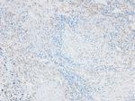 Phospho-Caveolin 2 (Ser23) Antibody in Immunohistochemistry (Paraffin) (IHC (P))