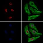 Phospho-Rb (Thr252) Antibody in Immunocytochemistry (ICC/IF)