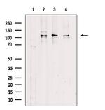 Phospho-Rb (Thr252) Antibody in Western Blot (WB)